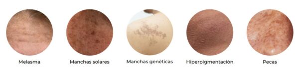 INDIBA PRINT - Pack 3 unidades - Nutricosmético para Prevenir, reducir y unificar manchas, hiper-pigmentaciones y ojeras. (copia) - Imagen 4